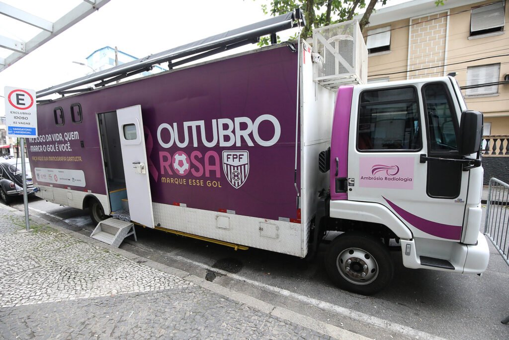 Santos recebe ônibus de mamografia gratuita em outubro (Foto: Pedro Ernesto Guerra Azevedo/Santos FC)